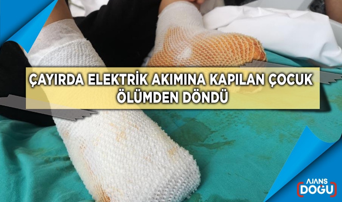 Çayırda elektrik akımına kapılan çocuk ölümden döndü