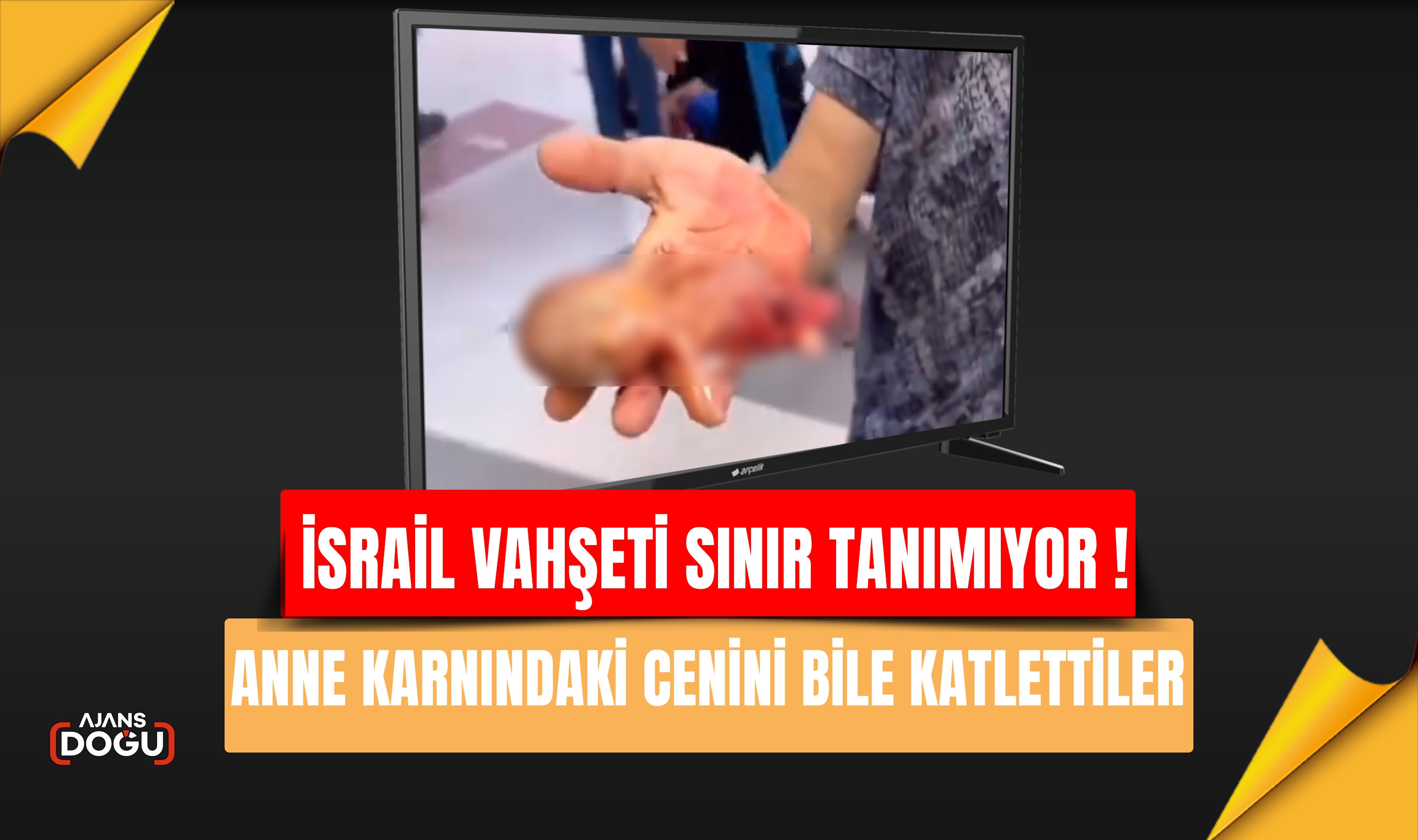 İsrail Vahşette sınır tanımıyor,Doğmamış bebeği bile katlediyor.